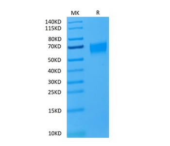 Recombinant human IL-17RA protein, C-His-Avi (HEK293), Biotin conjugated