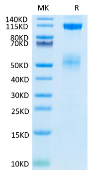 Recombinant human IGF1R protein, C-His-Avi (HEK293), Biotin conjugated