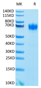 Recombinant human GM-CSF R Alpha protein, C-His-Avi (HEK293), Biotin conjugated