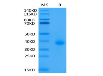 Recombinant human CD40 protein, C-His-Avi (HEK293), Biotin conjugated