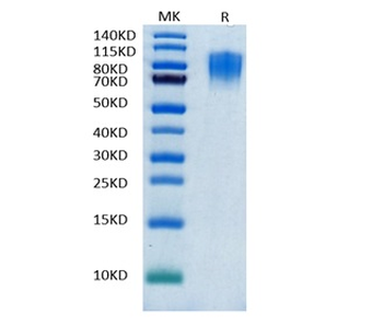 Recombinant human CD30 protein, C-His-Avi (HEK293), Biotin conjugated