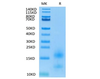 Recombinant human BCMA protein, C-His-Avi (HEK293), Biotin conjugated
