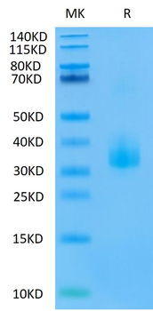 Recombinant human Angiopoietin-like 3 protein, C-His-Avi (HEK293), Biotin conjugated