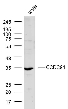 CCDC94 Rabbit Polyclonal Antibody