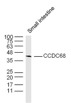 CCDC68 Rabbit Polyclonal Antibody