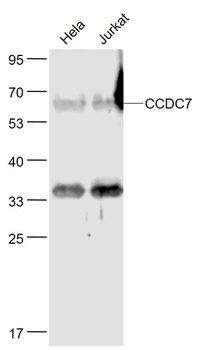 CCDC7 antibody