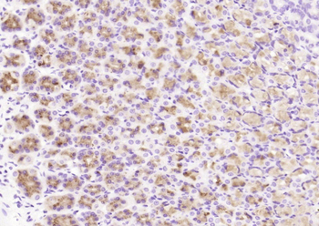 CCDC80 Rabbit Polyclonal Antibody