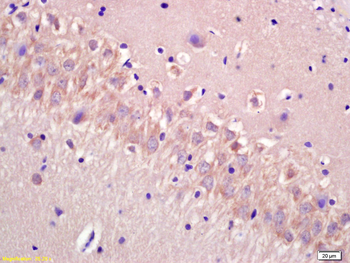CECR5 Rabbit Polyclonal Antibody