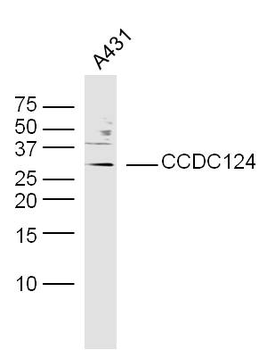 CCDC124 Rabbit Polyclonal Antibody