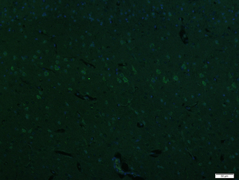 NHLRC2 Rabbit Polyclonal Antibody (BF488)