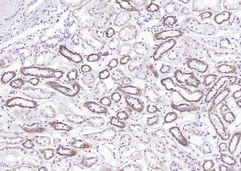 KLHL24 Rabbit Polyclonal Antibody