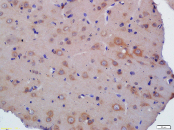 KLHL24 Rabbit Polyclonal Antibody
