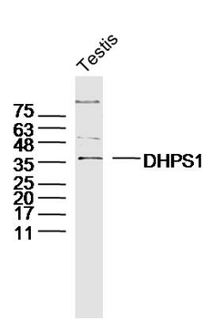 DHPS1 Rabbit Polyclonal Antibody