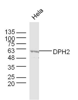 DPH2 Rabbit Polyclonal Antibody