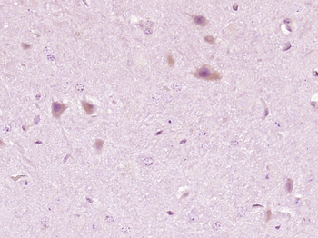 CRMP5 Rabbit Polyclonal Antibody
