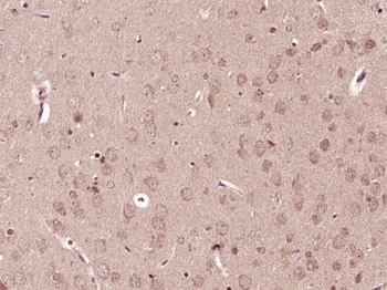 Phospho-CRMP2 (Thr514+Ser518) Rabbit Polyclonal Antibody