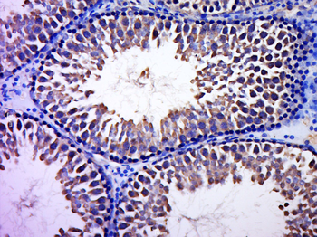 CCDC93 Rabbit Polyclonal Antibody