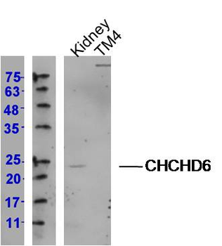 CHCHD6 Rabbit Polyclonal Antibody