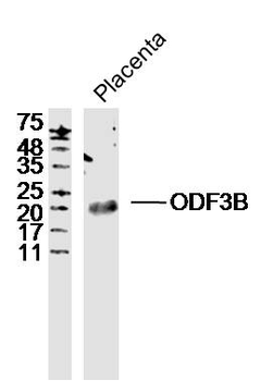 ODF3B Rabbit Polyclonal Antibody