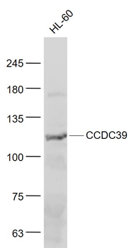 CCDC39 Rabbit Polyclonal Antibody