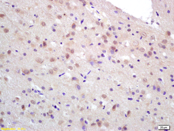 CCDC12 Rabbit Polyclonal Antibody