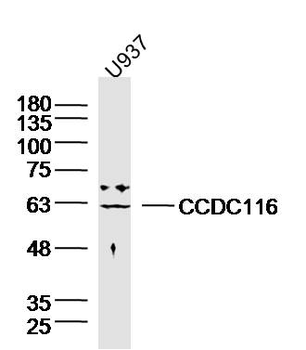 CCDC116 Rabbit Polyclonal Antibody