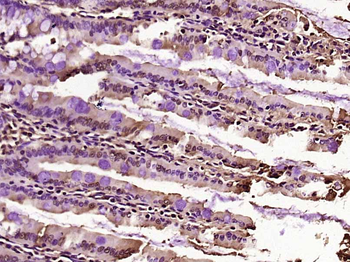 CCDC160 Rabbit Polyclonal Antibody