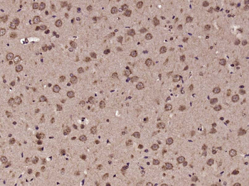 CCDC42 Rabbit Polyclonal Antibody
