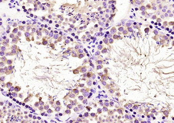 CCDC46 Rabbit Polyclonal Antibody