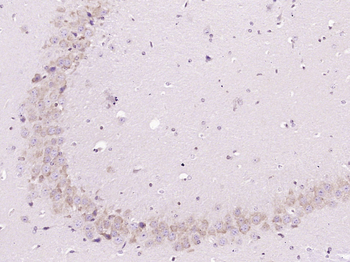 CCDC61 Rabbit Polyclonal Antibody