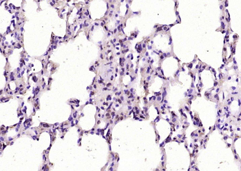 ZNF144 Rabbit Polyclonal Antibody