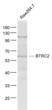 BTRC2 Rabbit Polyclonal Antibody