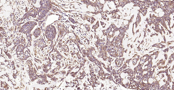 Human HSP47 Ready-To-Use IHC Kit