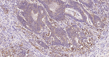 HSP47 Ready-To-Use IHC Kit
