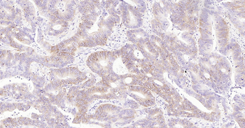 CD138 Ready-To-Use IHC Kit