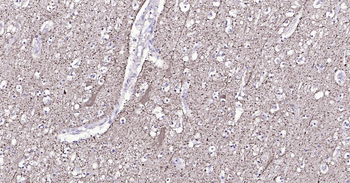 Human NF-M Ready-To-Use IHC Kit