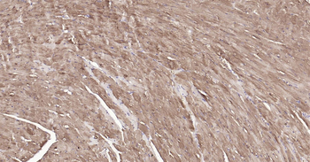Mouse S100A1 Ready-To-Use IHC Kit