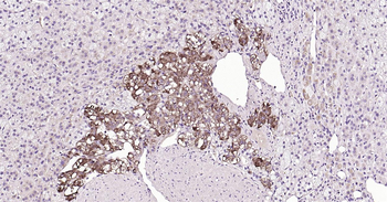 Human CHGA Ready-To-Use IHC Kit