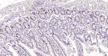 CHGA Ready-To-Use IHC Kit