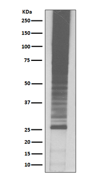 K48-linkage specific ubiquitin Recombinant Rabbit Monoclonal Antibody