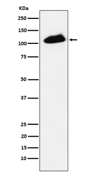 Phospho-TRIM28 (Ser824) Recombinant Rabbit Monoclonal Antibody
