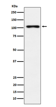 Thyroid peroxidase Recombinant Rabbit Monoclonal Antibody