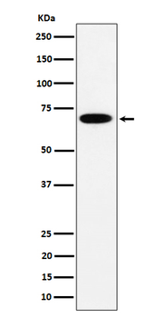 FATP4 Recombinant Rabbit Monoclonal Antibody