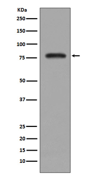 PKC beta Recombinant Rabbit Monoclonal Antibody