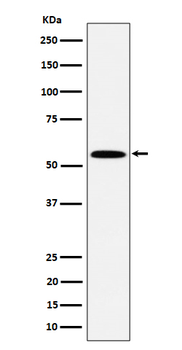 PNKP Recombinant Rabbit Monoclonal Antibody