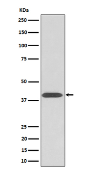 Phospho-PKA C alpha/beta/gamma (T197) Recombinant Rabbit Monoclonal Antibody