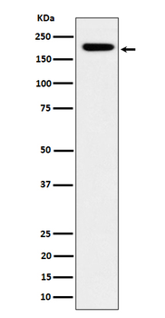 IQGAP2 Recombinant Rabbit Monoclonal Antibody
