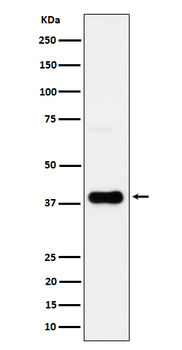 CXCR6/BONZO Recombinant Rabbit Monoclonal Antibody