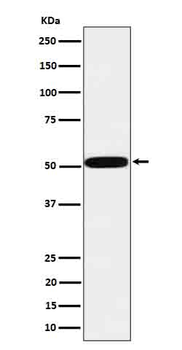 HTRA1 Recombinant Rabbit Monoclonal Antibody