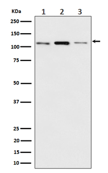 TMEM67/Meckelin Recombinant Rabbit Monoclonal Antibody